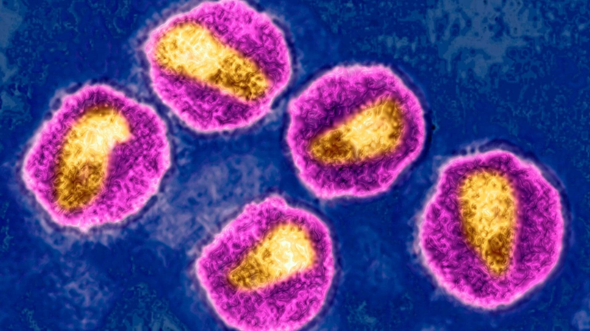 Norway Man Cured of HIV With Brother’s Stem Cells - Gizmodo